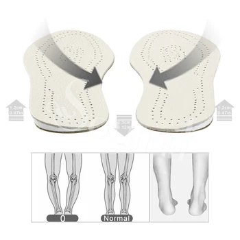 Soumit Ortopedski Vložki za Čevlje O/X Tip Noge Popravek Vstavite Ploščico Cowhide Usnje Zunanji Notranji Čevelj Tipke za Moške, Ženske